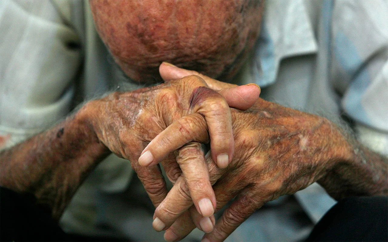 El aumento de la esperanza de vida se ralentiza pese a los avances de la medicina, apunta estudio